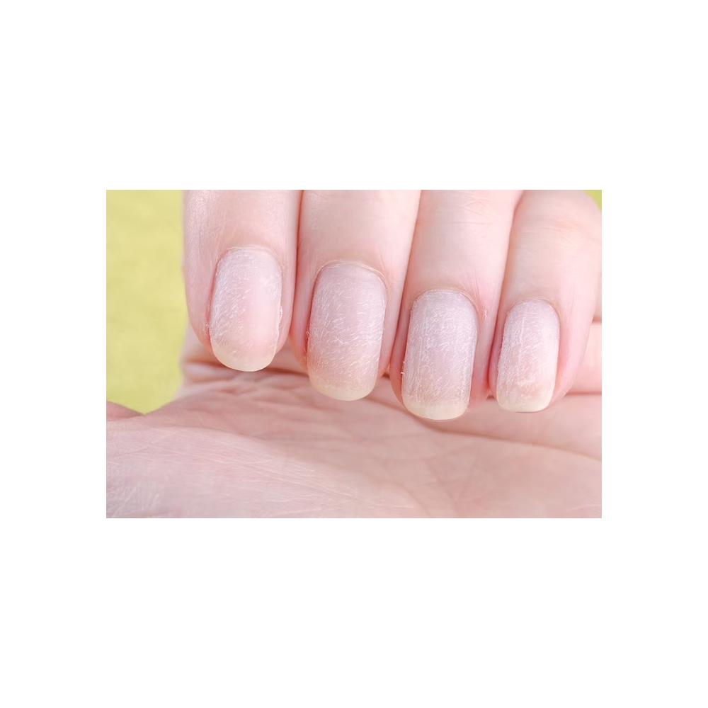 Πώς να διορθώσετε τα κατεστραμμένα Νύχια | Nailshop.gr